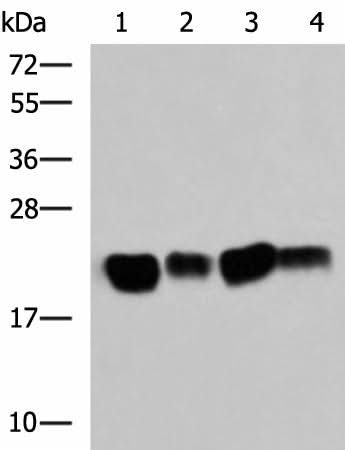 Western blot analysis of Mouse brain tissue SKOV3 cell Rat brain tissue Mouse kidney tissue lysates using HRAS Polyclonal Antibody at dilution of 1:500