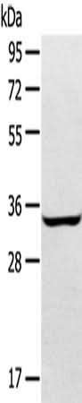 Anti-Human/Mouse/Rat STX2 Antibody - ABMIUM