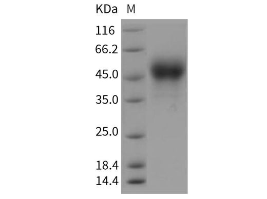 Recombinant Rat Tissue Factor/CD142 Protein (His Tag) - ABMIUM