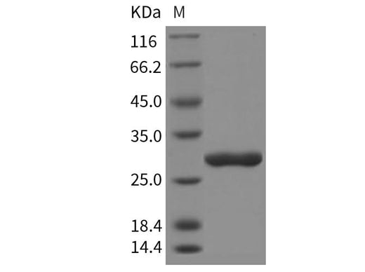 Recombinant Rat Chymotrypsinogen B/CTRB1 Protein (His Tag) - ABMIUM
