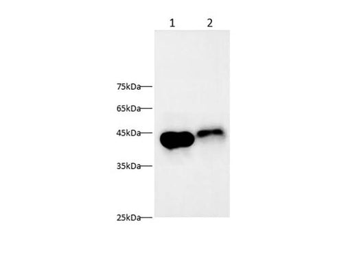 Anti-Human/Mouse/Rat AGER Antibody - ABMIUM