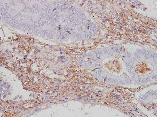 Anti-Human CTLA4 Antibody - ABMIUM