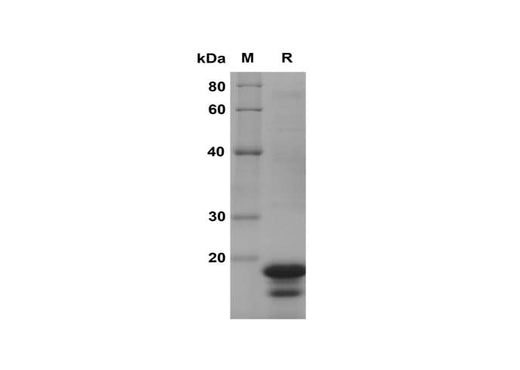 SDS-PAGE analysis of Human APC proteins, 2 μg/lane of Recombinant Human APC proteins was resolved with SDS-PAGE under reducing conditions, showing bands at 18 kDa.