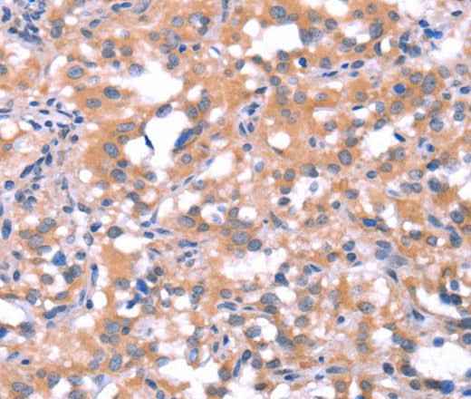 Anti-Human FAT1 Antibody