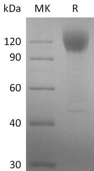 Recombinant SARS-CoV-2 S1 Protein (His Tag)(D614G) - ABMIUM