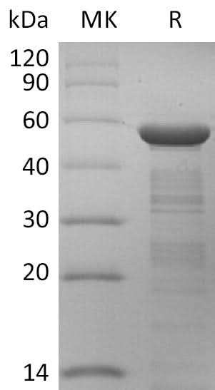 Recombinant HCoV-229E Nucleocapsid Protein - ABMIUM