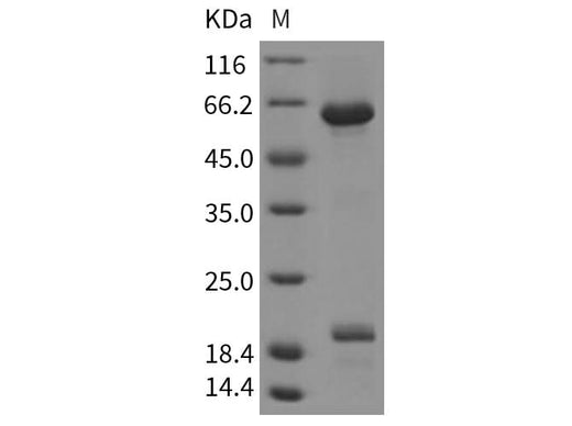 Recombinant Rat B7-H6/NCR3LG1 Protein (ECD, Fc Tag) - ABMIUM
