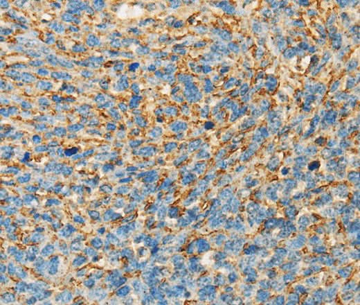 Anti-Human APOA4 Antibody - ABMIUM