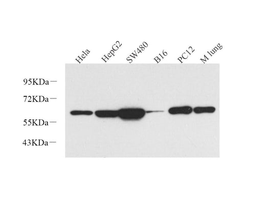 Western Blot analysis of various samples using Vimentin Polyclonal Antibody at dilution of 1:1000.