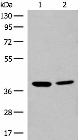 Western blot analysis of K562 and HEPG2 cell lysates using MRM1 Polyclonal Antibody at dilution of 1:400