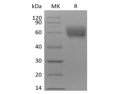 Recombinant Cynomolgus TPBG/5T4 (C-6His) - ABMIUM