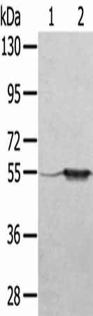 Anti-Human TRIM35 Antibody - ABMIUM