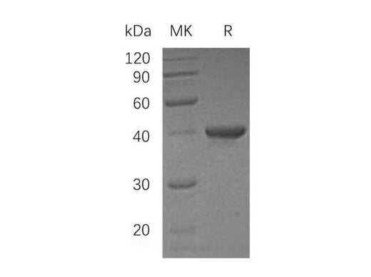Recombinant Human UBE2I/UBC9 Protein (GST Tag) - ABMIUM