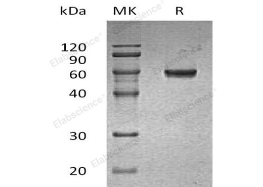 Recombinant Human GLUL Protein (His Tag) - ABMIUM