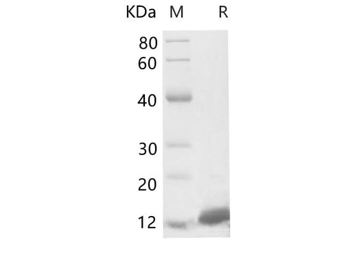 SDS-PAGE analysis of Human S100A11 proteins, 2 μg/lane of Recombinant Human S100A11 proteins was resolved with SDS-PAGE under reducing conditions, showing bands at 13-15 kDa.