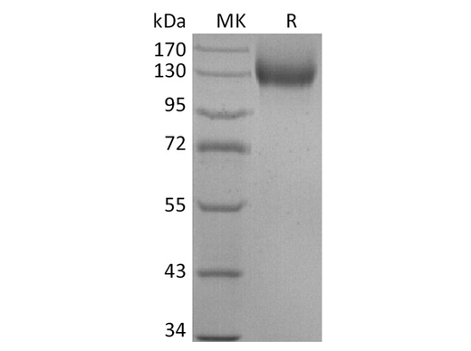 Recombinant Human ACE2 Protein (mFc Tag) - ABMIUM