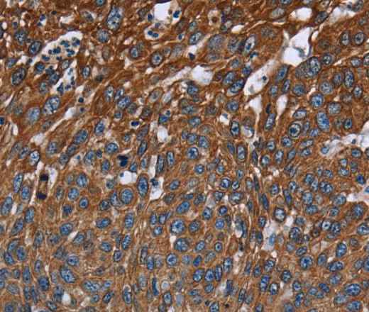 Anti-Human FCGR3A Antibody