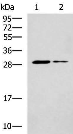 Western blot analysis of Mouse liver tissue and Mouse skeletal muscle tissue lysates using POMC Polyclonal Antibody at dilution of 1:800
