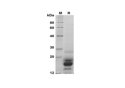 SDS-PAGE analysis of Human CSF2 proteins, 2 μg/lane of Recombinant Human CSF2 proteins was resolved with SDS-PAGE under reducing conditions, showing bands at 16 kDa.