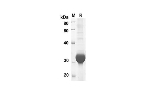 SDS-PAGE analysis of Rat GAL1 proteins, 2 μg/lane of Recombinant Rat GAL1 proteins was resolved with SDS-PAGE under reducing conditions, showing bands at 34.7 kDa.