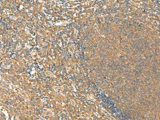 Immunohistochemistry of paraffin-embedded Human tonsil tissue using HTT Polyclonal Antibody at dilution of 1:25(×200)