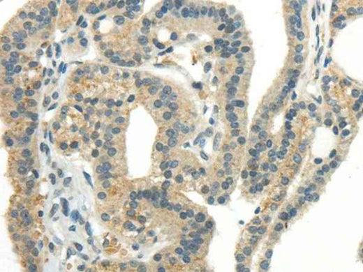 Anti-Human CCL13 Antibody - ABMIUM