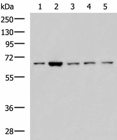 Western blot analysis of 293T LOVO Hela and Jurkat cell lysates using CHEK2 Polyclonal Antibody at dilution of 1:600