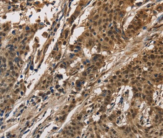 Anti-Human/Mouse CCAR1 Antibody - ABMIUM
