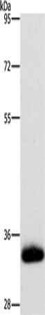 Anti-Human AMBP Antibody - ABMIUM