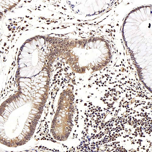 Immunohistochemistry analysis of paraffin-embedded human colon using LEP Polyclonal Antibody at dilution of 1:100.