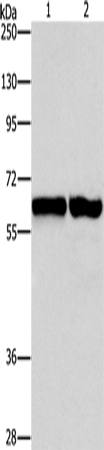 Anti-Human/Mouse/Rat ASNS Antibody - ABMIUM