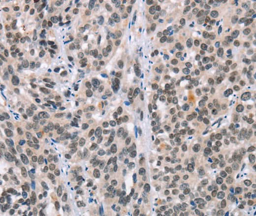 Anti-Human/Mouse/Rat ADNP Antibody - ABMIUM