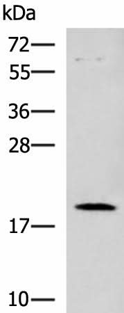 Western blot analysis of Human heart tissue lysate using DNPH1 Polyclonal Antibody at dilution of 1:800