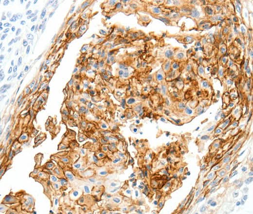 Anti-Human/Mouse SEMA3D Antibody - ABMIUM