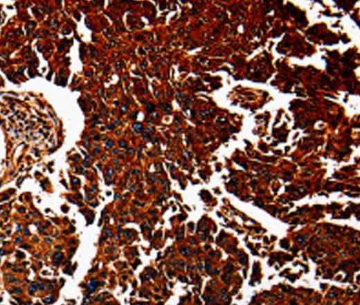 Anti-Human/Mouse ANXA7 Antibody