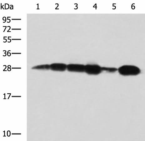 Western blot analysis of 293T cell Human bladder transitional cell carcinoma grade 2-3 tissue lysate MCF-7 cell lysates using MMAB Polyclonal Antibody at dilution of 1:1400