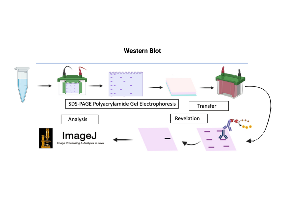 Overview of Western Blot procedure
