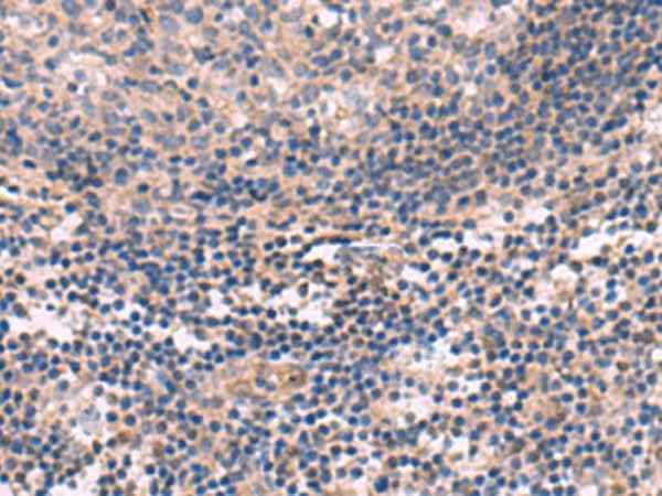 Anti-Human/Mouse/Rat KCNT1 Antibody