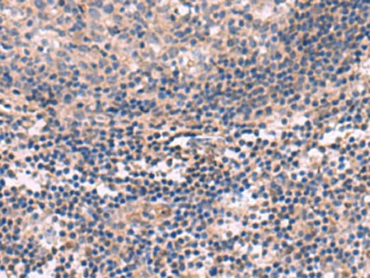 Immunohistochemistry of paraffin-embedded Human tonsil tissue using KCNT1 Polyclonal Antibody at dilution of 1:30(×200)