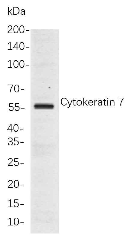 Anti-Human/Mouse/Rat Cytokeratin 7 Antibody [B895] - ABMIUM