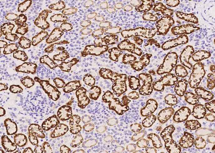 Anti-Human Vsir Antibody [A1081] - ABMIUM