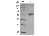 Recombinant SARS-CoV-2 Spike Protein, Biotinylated (RBD-SD1, Avi-His Tag) - ABMIUM