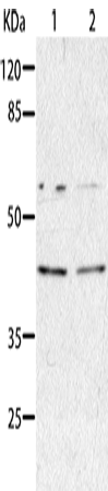Anti-Human/Mouse/Rat AIMP2 Antibody - ABMIUM
