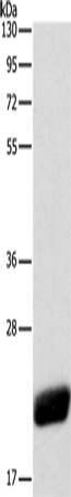 Anti-Human/Mouse/Rat CAV1 Antibody - ABMIUM