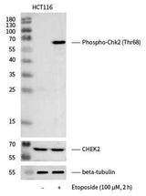Anti-Human CHEK2 Antibody [A1265] - ABMIUM
