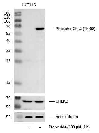 Anti-Human CHEK2 Antibody [A1265] - ABMIUM