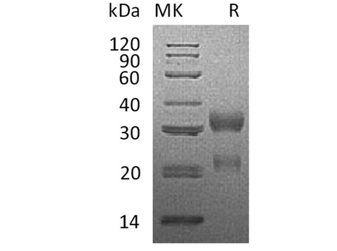 Recombinant Human CGA&CGB3 Heterodimer Protein (His & Flag Tag) - ABMIUM