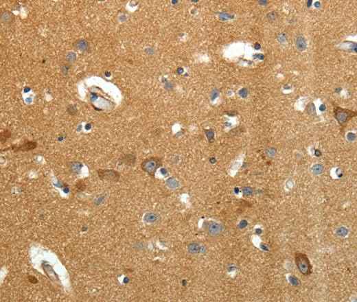 Anti-Human/Mouse/Rat AMD1 Antibody