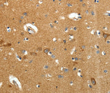 Anti-Human/Mouse/Rat AMD1 Antibody - ABMIUM