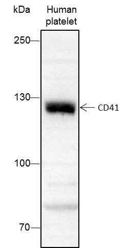 Anti-Human CD41 Antibody [A173] - ABMIUM